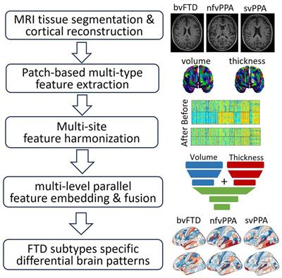 Differential diagnosis of frontotemporal dementia subtypes with explainable deep learning on structural MRI